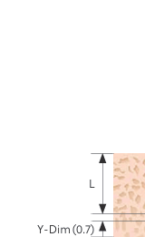 Bone Density