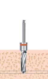 F4.0 Drill