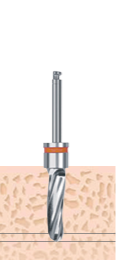 F4.0 Drill