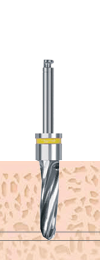 F3.5 Drill