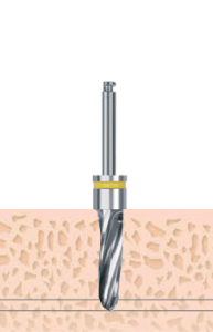 F3.5 Drill