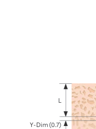 Bone Density