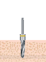 F3.5 Drill