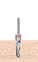F4.0 Drill