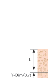Bone Density